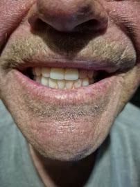 Smile Dental - Family Dental Clinic in Kalgoorlie