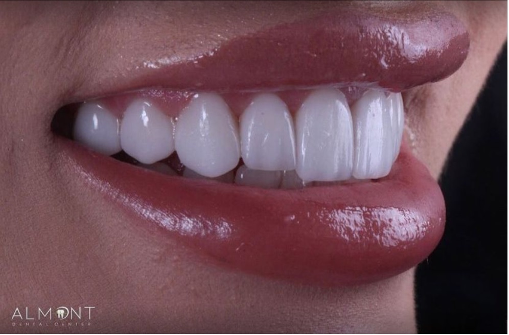 Almont Dental - dental clinic in Tijuana