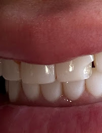 Amatista l Estética Dental Tijuana