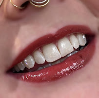 Dazzle Teeth Tooth Gems and Grillz