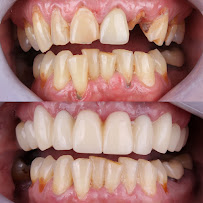 Aesthetic Smiles Studio - Tijuana Dentist