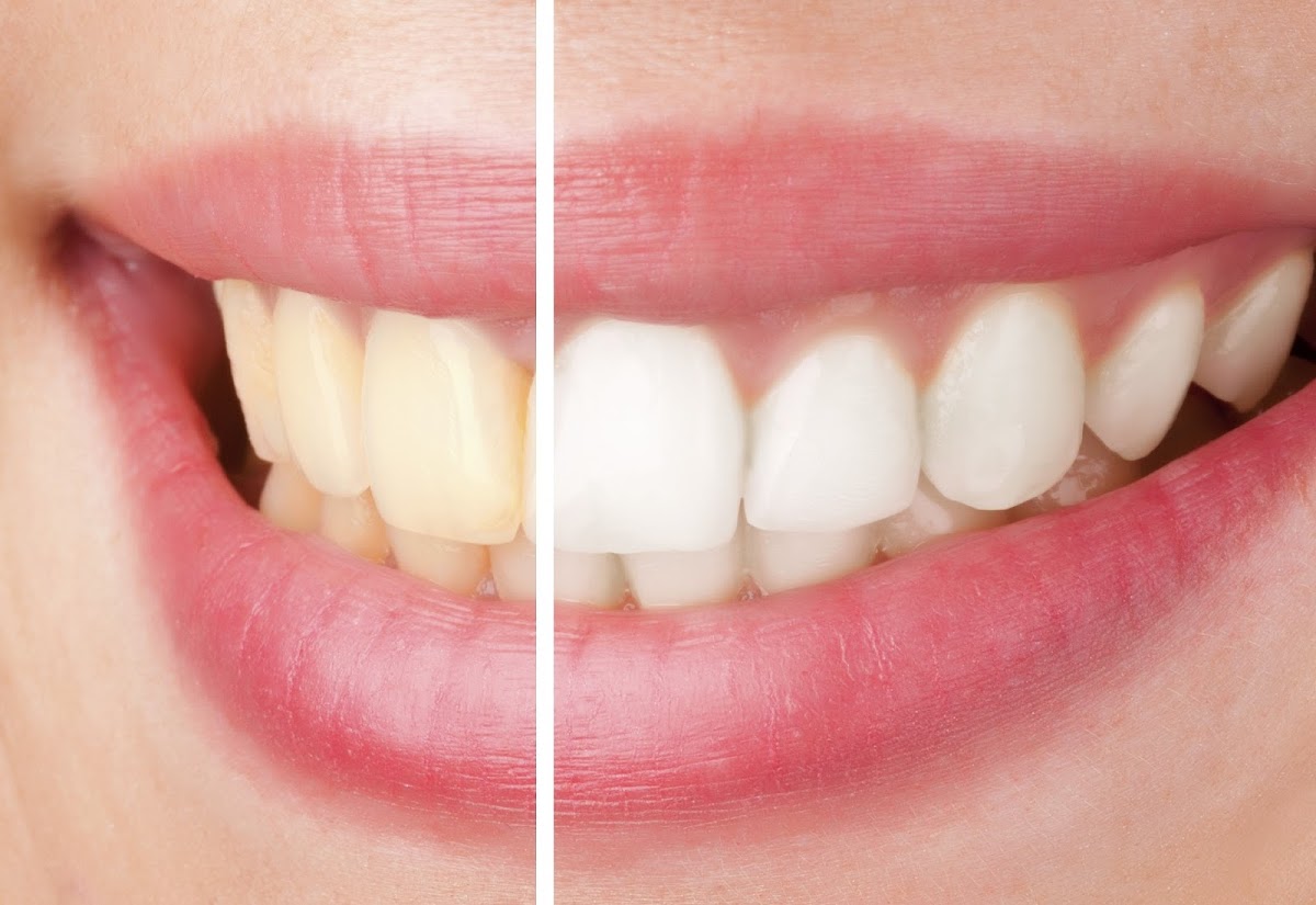 Sparklewhite Teeth Christchurch - dental clinic in Christchurch, New Zealand