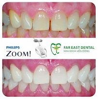 Far East Dental Clinic