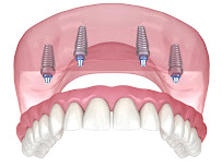 ER Dental at Seventh