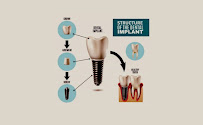 HAPPY TEETH TIJUANA DENTAL