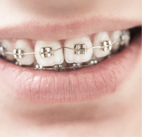 Beyond Dental Papamoa