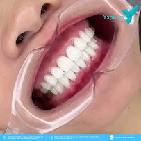 Nha Khoa Thẩm Mỹ Ysmiles - Sài Gòn Pearl - Bình Thạnh