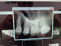 Molar Operations Co./Dentist In Tijuana