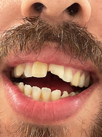 Molar Operations Co./Dentist In Tijuana