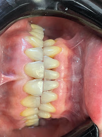 Molar Operations Co./Dentist In Tijuana