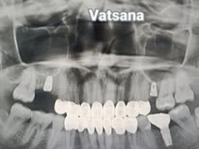 Vatsana Dental Clinic clinic interior in Vientiane