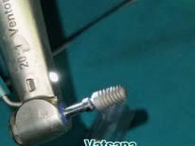 Vatsana Dental Clinic dental equipment in Vientiane