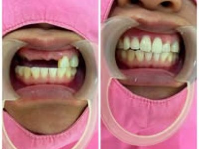 See Smile Dental Clinic in Vientiane, Laos, photograph 9
