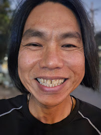 Smile Dental Clinic - ຄລີນິກປົວແຂ້ວ ສະມາຍ