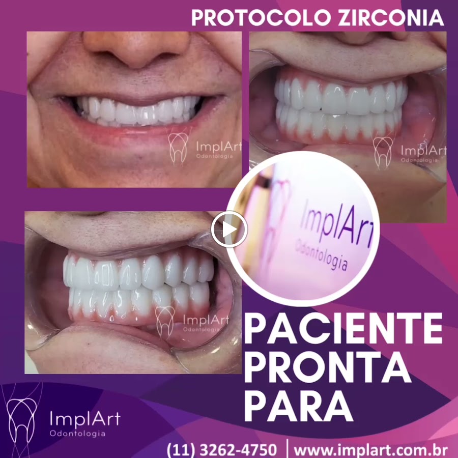 Implart - dental clinic in São Paulo, Brazil