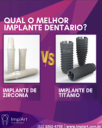 Implart