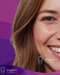 Implart