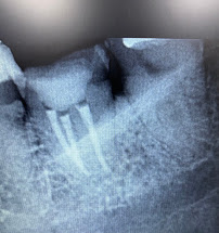 Dentista 24h - Centro SP - Urgências - Dr. Bruno Frison - CROSP 128.512