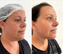 Dentista 24h - Centro SP - Urgências - Dr. Bruno Frison - CROSP 128.512