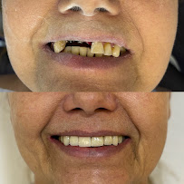 Dentista 24h - Centro SP - Urgências - Dr. Bruno Frison - CROSP 128.512