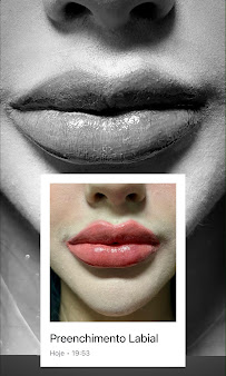 Dentista 24h - Centro SP - Urgências - Dr. Bruno Frison - CROSP 128.512