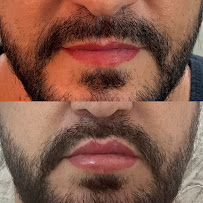 Dentista 24h - Centro SP - Urgências - Dr. Bruno Frison - CROSP 128.512
