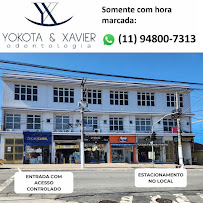YOKOTA & XAVIER, Dentista Zona Leste SP, Clinica Vila Matilde, Especialista, Melhor: Implante Dentario Canal BucoMaxilo Siso