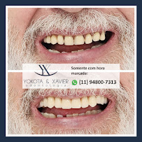 YOKOTA & XAVIER, Dentista Zona Leste SP, Clinica Vila Matilde, Especialista, Melhor: Implante Dentario Canal BucoMaxilo Siso