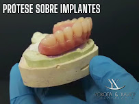 YOKOTA & XAVIER, Dentista Zona Leste SP, Clinica Vila Matilde, Especialista, Melhor: Implante Dentario Canal BucoMaxilo Siso