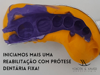 YOKOTA & XAVIER, Dentista Zona Leste SP, Clinica Vila Matilde, Especialista, Melhor: Implante Dentario Canal BucoMaxilo Siso