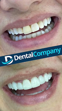 Dental Company
