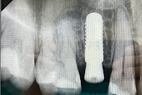 In Style Dental Clinic Tijuana
