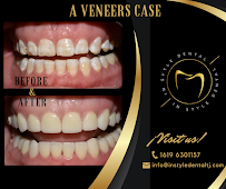 In Style Dental Clinic Tijuana