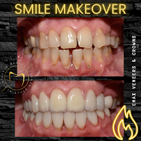 In Style Dental Clinic Tijuana