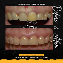 In Style Dental Clinic Tijuana