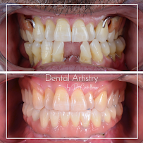 Dental Artistry Tijuana by Dr. Castellanos