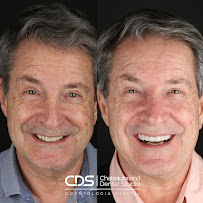 CDS Odontologia Digital - Lente de contato dental em Tatuapé - Lente de porcelana em Tatuapé - Protocolo Fixo