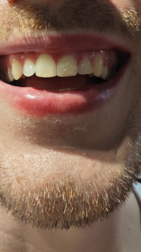 Consultório Odontológico Particular Bianca Barata | Dentista Emergência 24h WhatsApp | Prótese, Implante - Copacabana/RJ