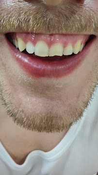 Consultório Odontológico Particular Bianca Barata | Dentista Emergência 24h WhatsApp | Prótese, Implante - Copacabana/RJ