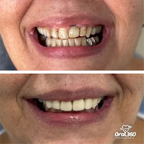 Clínica Odontológica Oral 360 Copacabana | Dentista