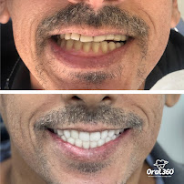 Clínica Odontológica Oral 360 Copacabana | Dentista