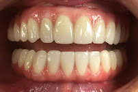 Dental Brush Tijuana