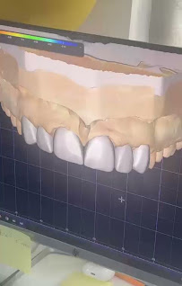 Dental Brush Tijuana