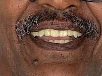 Dental Brush Tijuana