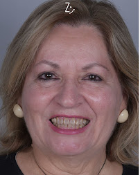 Odonto Liuzzi | Lentes de Contato Dental | Prótese Protocolo | Ortodontia | Periodontia | Implante Dentário | Dental Tourism