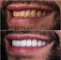 Odonto Liuzzi | Lentes de Contato Dental | Prótese Protocolo | Ortodontia | Periodontia | Implante Dentário | Dental Tourism