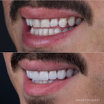 Odonto Liuzzi | Lentes de Contato Dental | Prótese Protocolo | Ortodontia | Periodontia | Implante Dentário | Dental Tourism