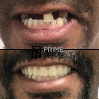 Dentista e Invisalign no Meier - Clinica Odontológica Prime Dente