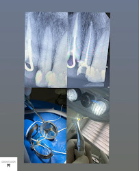 Clínica Odontológica Odontocor - Dentista Centro Rj | Especialista em Tratamento de Canal