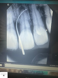 Clínica Odontológica Odontocor - Dentista Centro Rj | Especialista em Tratamento de Canal